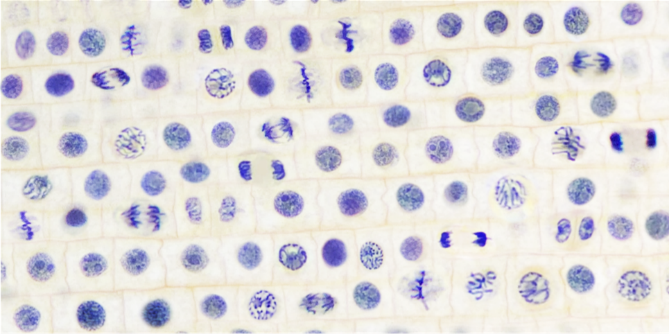 Composite micrograph of stained onion root cells with condensed chromosomes visible in several cells.